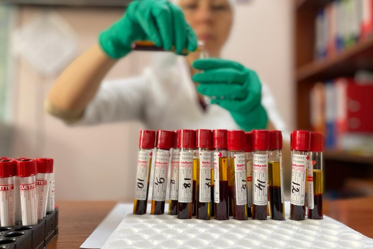 Итоги лабораторных исследований на АЧС, грипп птиц и бешенство за первый квартал 2022 года